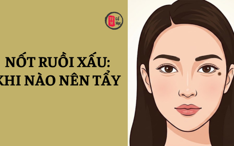 Nốt ruồi xấu là gì? Cách nhận biết và có nên tẩy nốt ruồi xấu? 18 Nốt ruồi xấu là gì? Cách nhận biết và có nên tẩy nốt ruồi xấu?