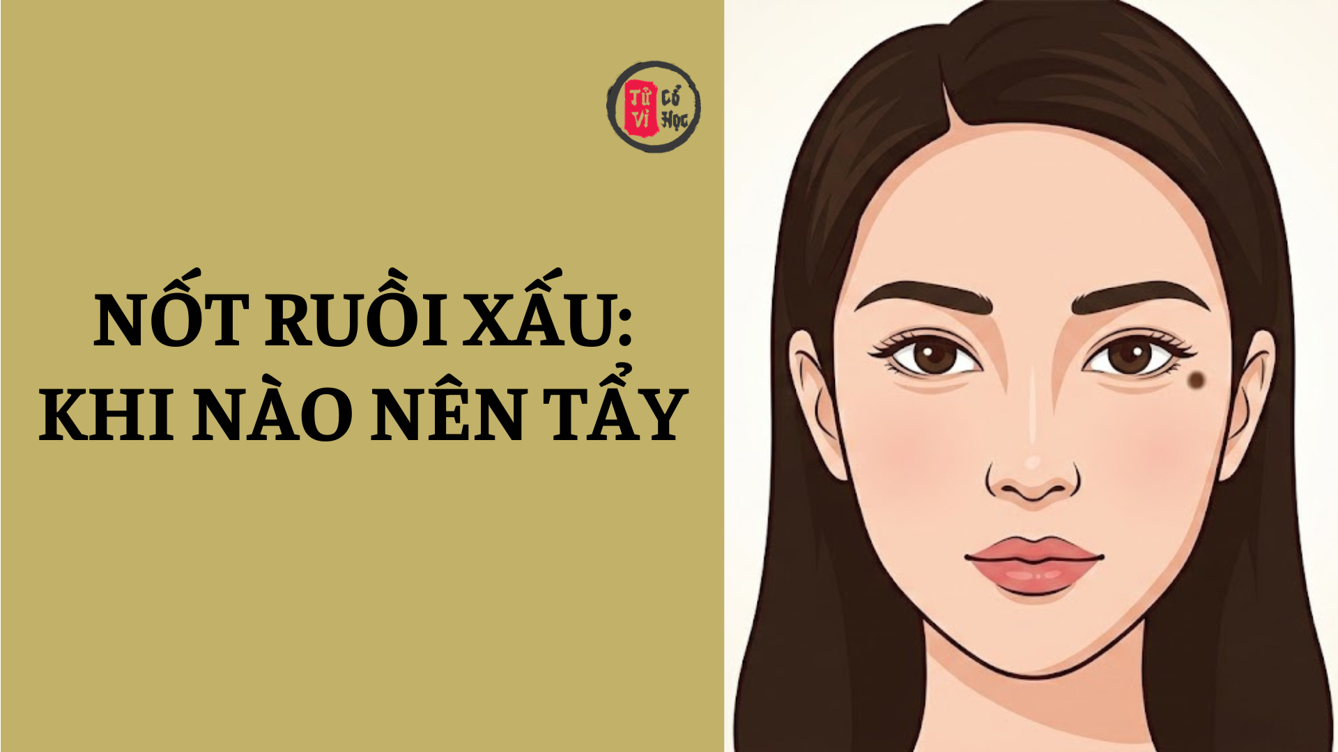 Nốt ruồi xấu là gì? Cách nhận biết và có nên tẩy nốt ruồi xấu? | Tử Vi Cổ Học