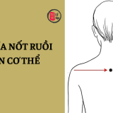 Ý nghĩa nốt ruồi đặc trưng trên cơ thể 7 Ý nghĩa nốt ruồi đặc trưng trên cơ thể | Tử Vi Cổ Học